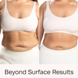 Anesi Lipoaminocel Cream 17.6oz 1