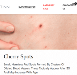 Superfrecator 6800M 3rd Generation - Removes Skin Imperfections + Plasma Fibroblast Skin Tightening 13 cherry spots