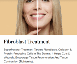 Superfrecator 6800M 3rd Generation - Removes Skin Imperfections + Plasma Fibroblast Skin Tightening 14 fibroblast