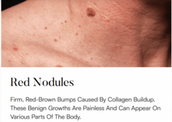 Superfrecator 6800M 3rd Generation - Removes Skin Imperfections + Plasma Fibroblast Skin Tightening 9 red nogules