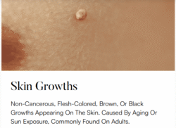 Superfrecator 6800M 3rd Generation - Removes Skin Imperfections + Plasma Fibroblast Skin Tightening 10 skin growths