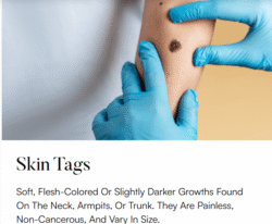 Superfrecator 6800M 3rd Generation - Removes Skin Imperfections + Plasma Fibroblast Skin Tightening 8 skintags