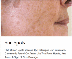 Superfrecator 6800M 3rd Generation - Removes Skin Imperfections + Plasma Fibroblast Skin Tightening 7 sunspots